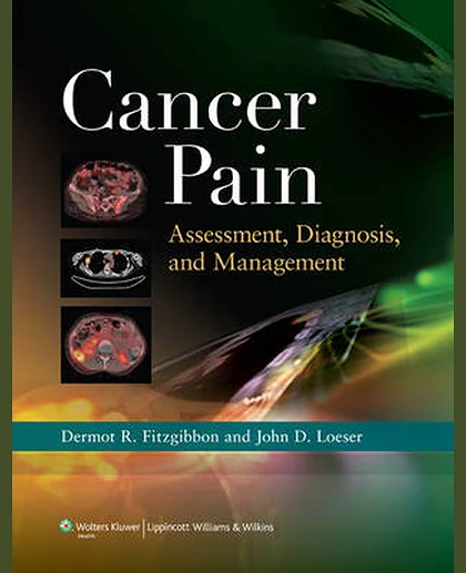 Cancer Pain