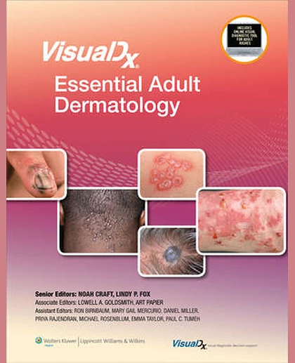 VisualDx: Essential Adult Dermatology