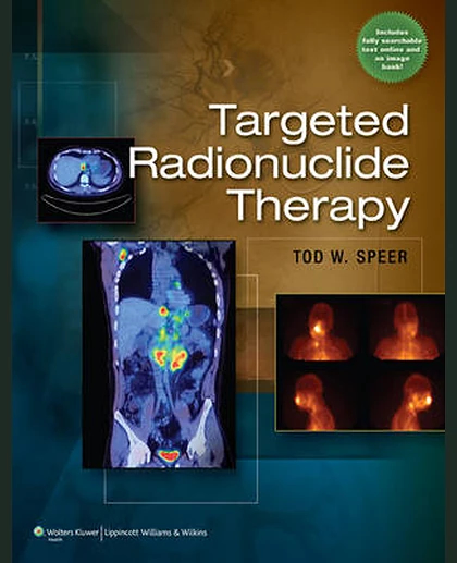 Targeted Radionuclide Therapy