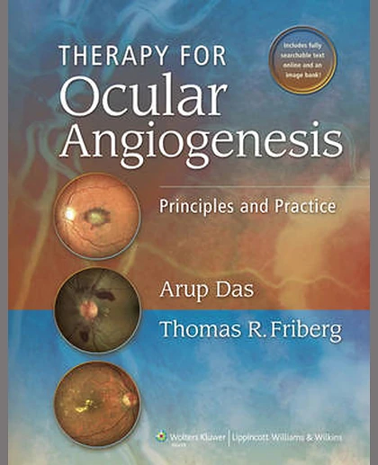 Therapy for Ocular Angiogenesis: Principles and Practice