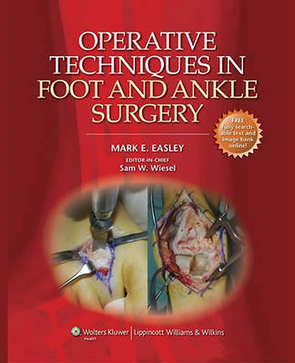 Operative Techniques in Foot and Ankle Surgery