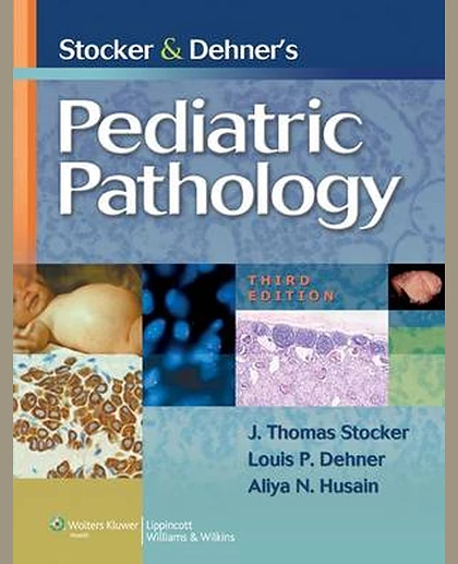 Stocker and Dehner's Pediatric Pathology
