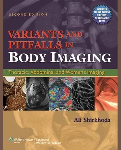 Variants and Pitfalls in Body Imaging: Thoracic, Abdominal and Women's Imaging