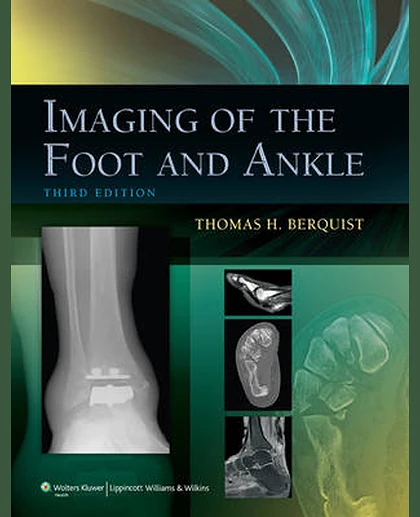 Imaging of the Foot and Ankle