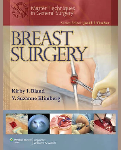 Master Techniques in General Surgery: Breast Surgery