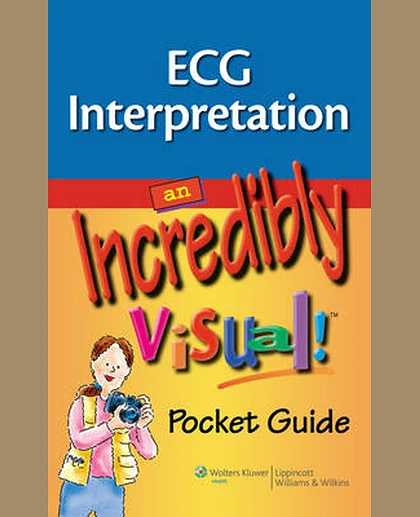 ECG Interpretation: An Incredibly Visual! Pocket Guide