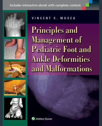Principles and Management of Pediatric Foot and Ankle Deformities and Malformations