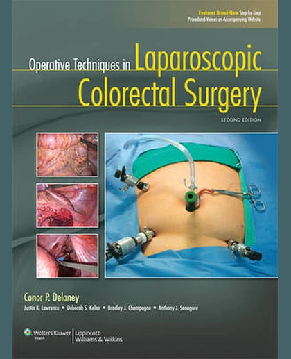 Operative Techniques in Laparoscopic Colorectal Surgery