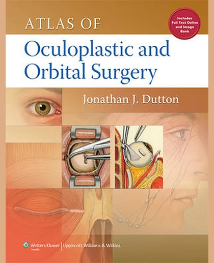 Atlas of Oculoplastic and Orbital Surgery