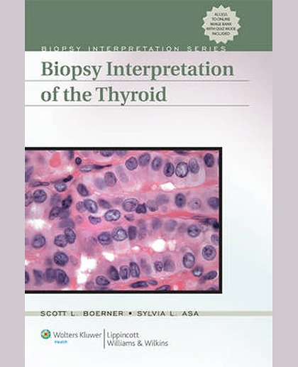 Biopsy Interpretation of the Thyroid