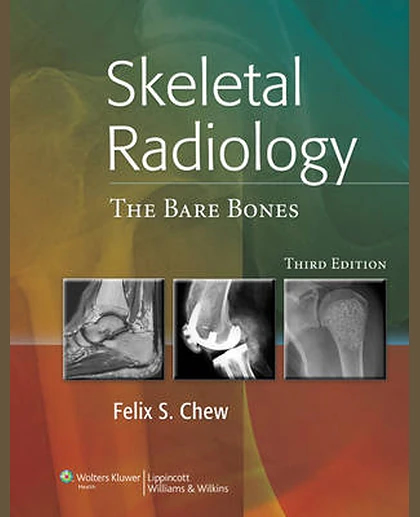 Skeletal Radiology: The Bare Bones
