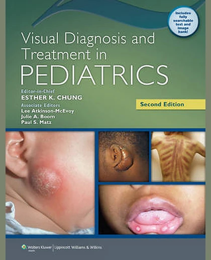 Visual Diagnosis and Treatment in Pediatrics