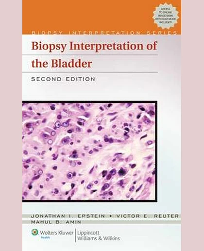 Biopsy Interpretation of the Bladder