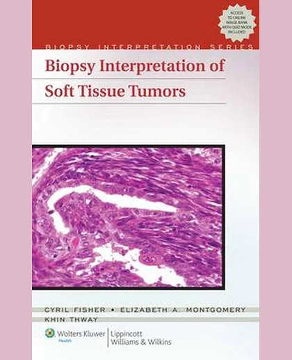 Biopsy Interpretation of Soft Tissue Tumors