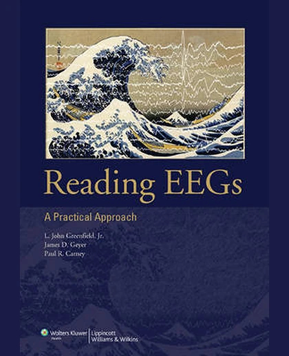 Reading EEGs: A Practical Approach