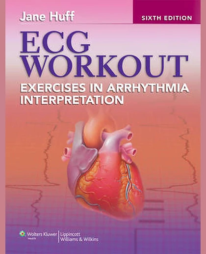 ECG Workout: Exercises in Arrhythmia Interpretation