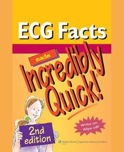ECG Facts Made Incredibly Quick!