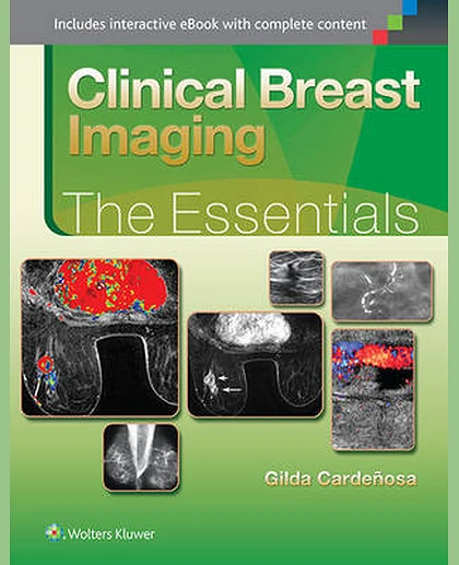 Clinical Breast Imaging: The Essentials