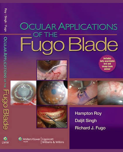 Ocular Applications of the Fugo Blade
