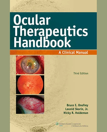 Ocular Therapeutics Handbook: A Clinical Manual