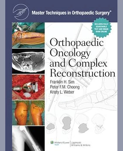 Master Techniques in Orthopaedic Surgery: Orthopaedic Oncology and Complex Reconstruction