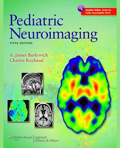 Pediatric Neuroimaging
