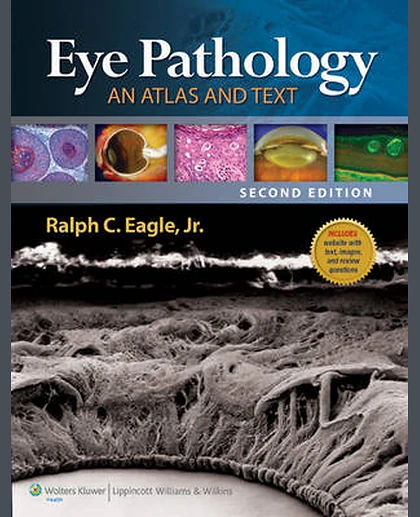 Eye Pathology: An Atlas and Text