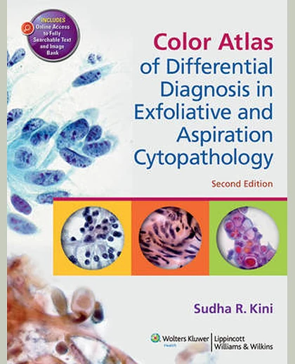 Color Atlas of Differential Diagnosis in Exfoliative and Aspiration Cytopathology