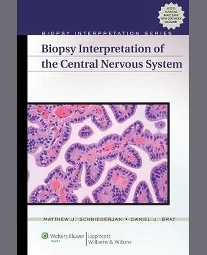 Biopsy Interpretation of the Central Nervous System