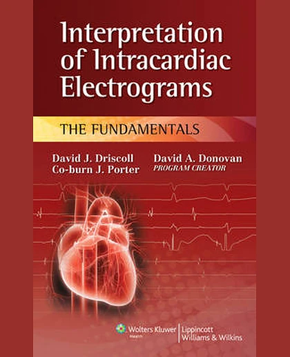 Interpretation of Intracardiac Electrograms: The Fundamentals
