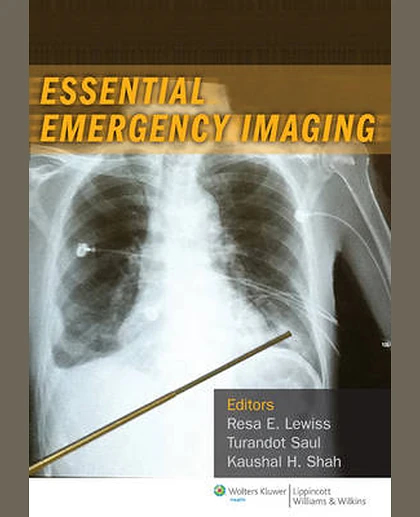 Essential Emergency Imaging