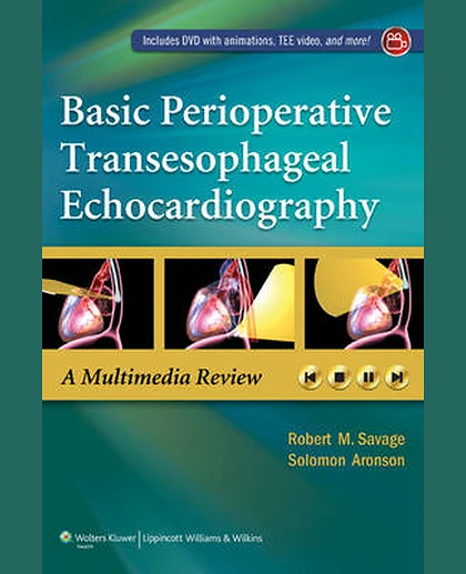 Basic Perioperative Transesophageal Echocardiography: A Multimedia Review