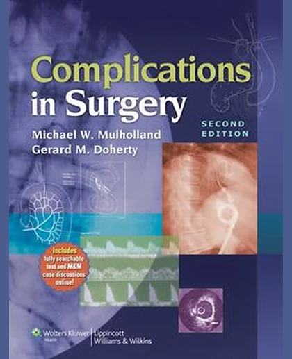 Complications in Surgery