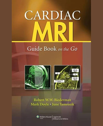 Cardiac MRI: Guide Book on the Go