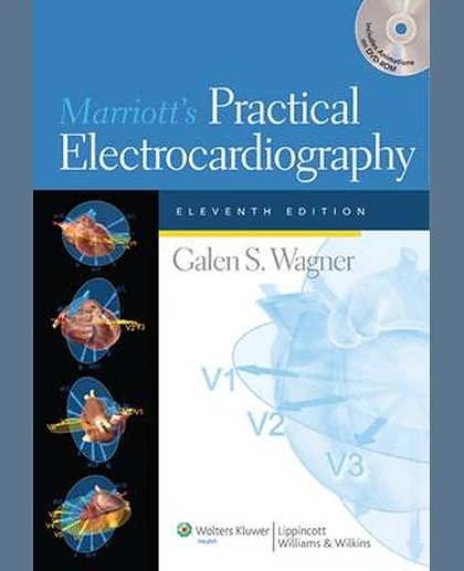 Marriott's Practical Electrocardiography