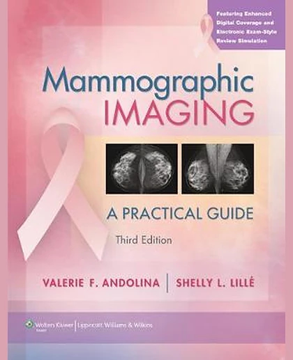 Mammographic Imaging: A Practical Guide