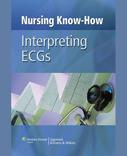 Nursing Know-how: Interpreting ECG's