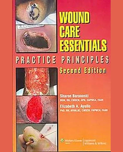 Wound Care Essentials: Practice Principles