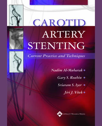 Carotid Artery Stenting: Current Practice and Techniques