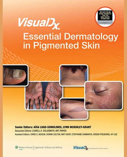 VisualDx: Essential Dermatology in Pigmented Skin