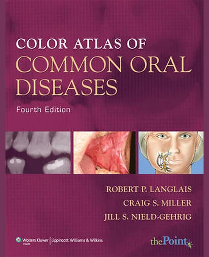 Color Atlas of Common Oral Diseases