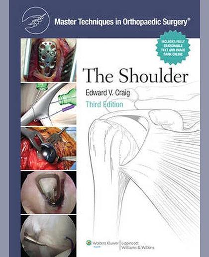 The Shoulder: Master Techniques in Orthopaedic Surgery
