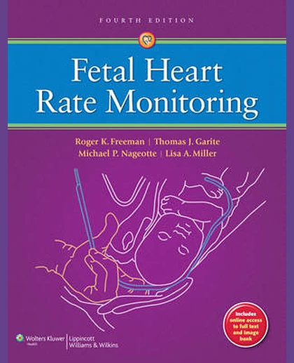 Fetal Heart Rate Monitoring