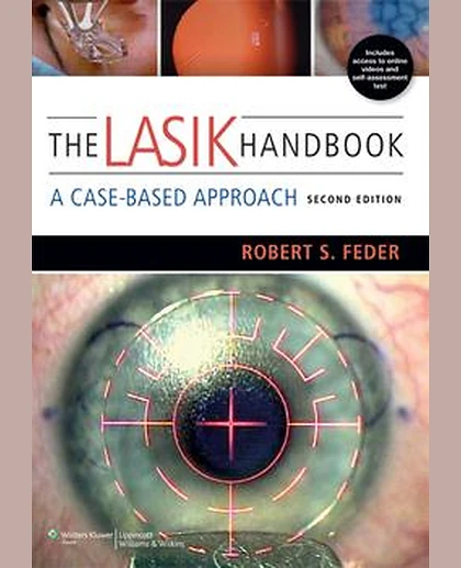 LASIK Handbook