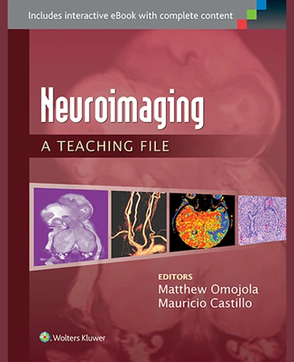 Neuroimaging: A Teaching File