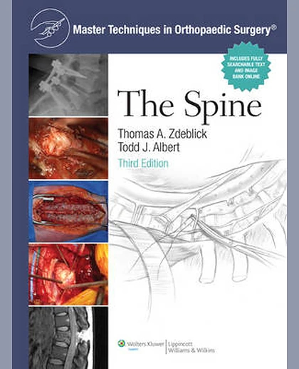 Master Techniques in Orthopaedic Surgery: The Spine