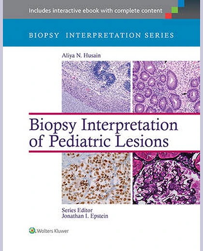 Biopsy Interpretation of Pediatric Lesions