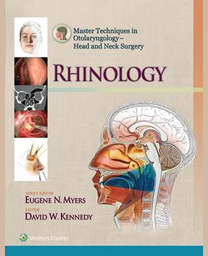 Master Techniques in Otolaryngology - Head and Neck Surgery: Rhinology