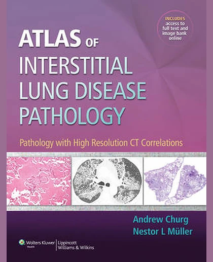 Atlas of Interstitial Lung Disease Pathology: Pathology with High Resolution CT Correlations