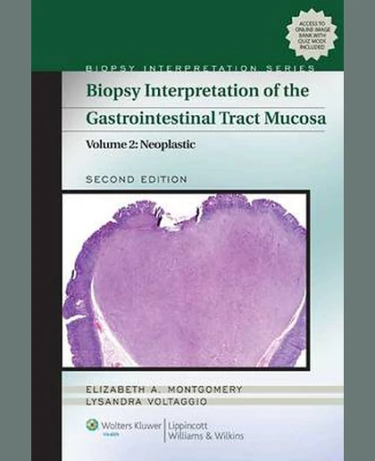 Biopsy Interpretation of the Gastrointestinal Tract Mucosa: Volume 2: Neoplastic